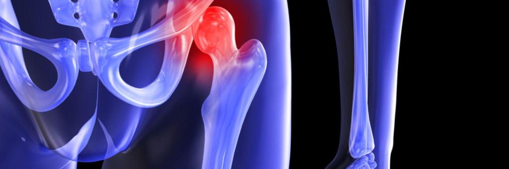 Information about the Joint Replacement Surgery benefits: